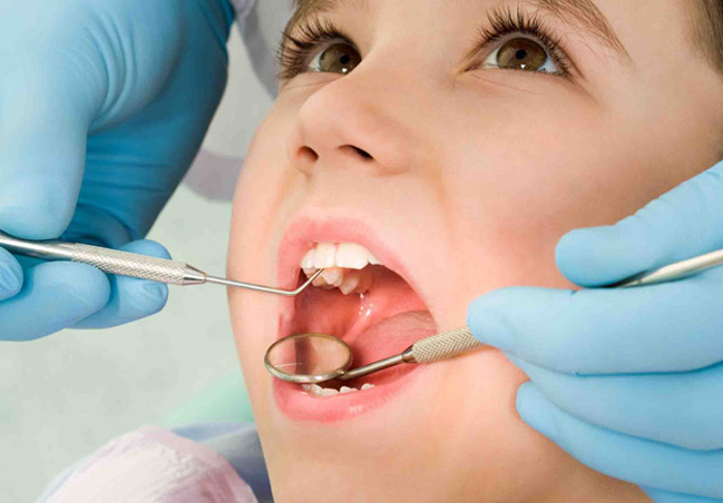 Why is professional dental care important for children?